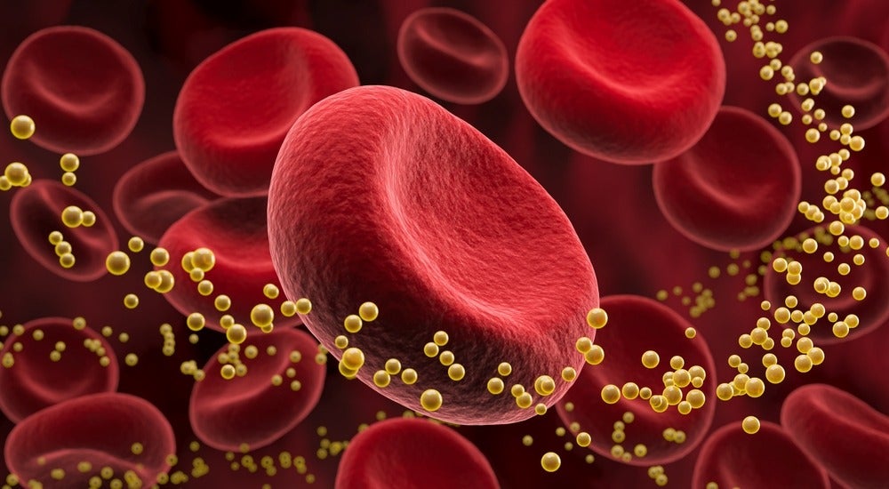 Rối loạn lipid máu có trị dứt điểm được không?
