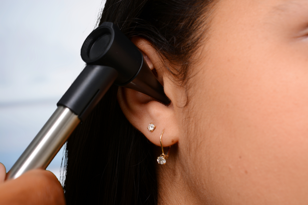 Chẩn đoán chóng mặt tư thế kịch phát lành tính